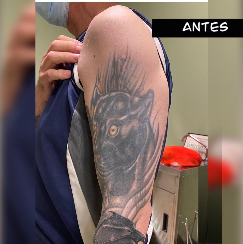 Tatuaje cover león brazo - Made Ink Bilbao